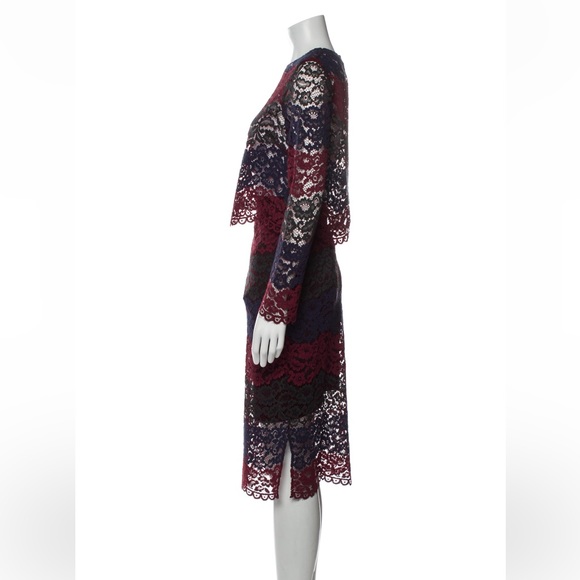 Sandro Lace Blouse + Skirt set - Picture 2 of 9